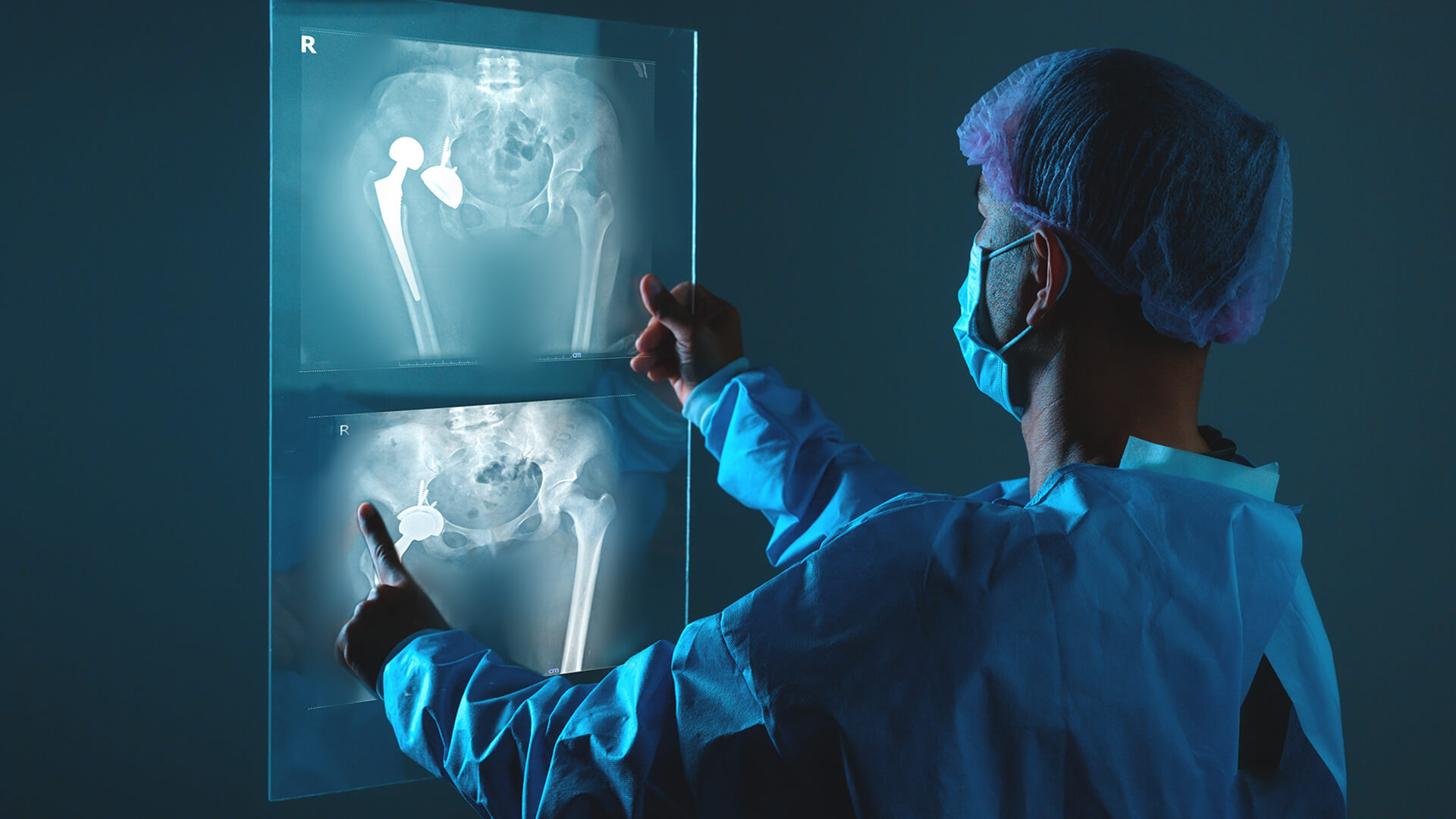 Surgical technician reviewing an x-ray.
